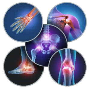 improve joints